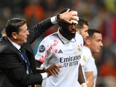 Tradisi Bek Real Madrid Berdarah-darah