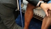 Kemudian, dokter itu turut memeriksa secara detail bagian kaki kiri Lukas (Foto: dok. istimewa)