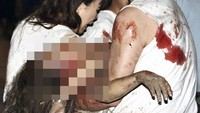 Seorang turis yang terluka dievakuasi beberapa saat setelah ledakan bom di Jimbaran, Bali. Tim Investigasi Gabungan Polri dan kepolisian luar negeri yang telah dibentuk untuk menangani kasus ini menyimpulkan, bom di Paddys Pub berjenis TNT seberat 1 kg dan di depan Sari Club, merupakan bom RDX berbobot antara 50-150 kg. Sementara bom di dekat konsulat Amerika Serikat menggunakan jenis TNT berbobot kecil yakni 0,5 kg. (Agung Mulyajaya/AFP/Getty Images).
