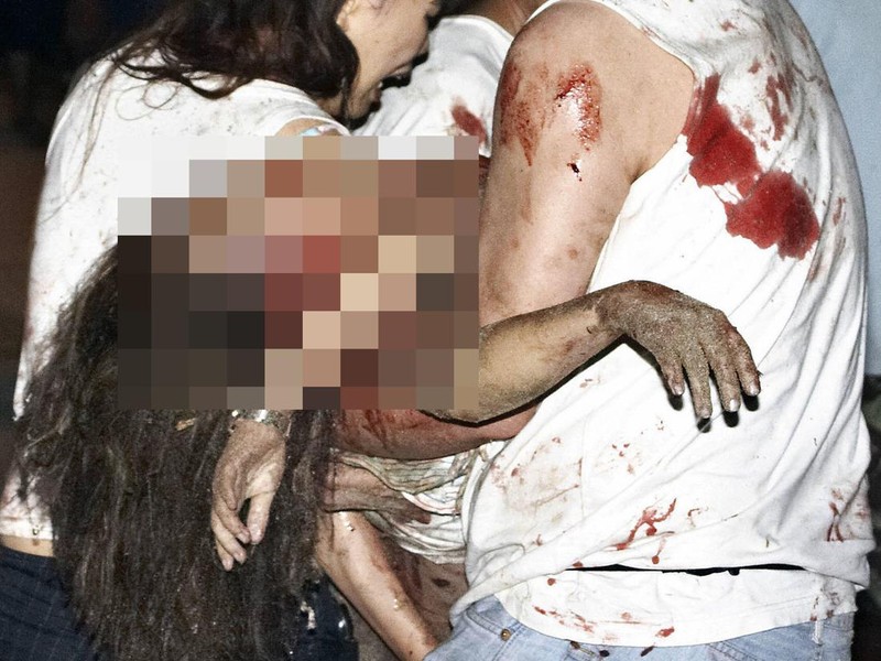 BALI, INDONESIA:  An injured tourist is evacuated moments after a bomb blast in Jimbaran, on Bali island, 01 October 2005.  At least 26 people were killed after a series of bomb attacks rocked the Indonesian resort island of Bali, as police are looking for three men suspected of involvement in the suicide blasts.  AFP PHOTO/Agung MULYAJAYA  (Photo credit should read AGUNG MULYAJAYA/AFP via Getty Images)