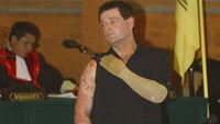 Saksi dan korban bom Bali Peter Hughes dari Australia, menunjukkan bekas luka bakarnya selama kesaksiannya di Denpasar, Bali, Senin (16/10/2003). (AP Photo/Suzanne Plunkett).
