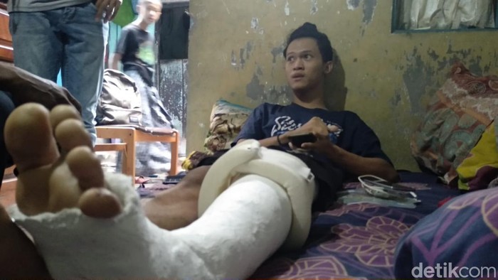 Bagas korban Tragedi Kanjuruhan mengalami patah tulang