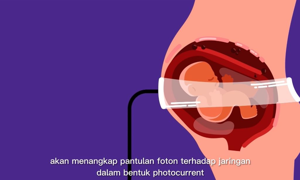 Cara kerja Fetox untuk janin.