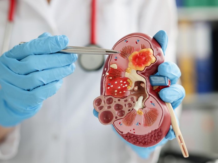 Close-up of urologist pointing pen kidney structure on anatomical model. Treatment of kidney diseases, pyelonephritis