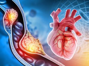 Ini Cara Memelihara Organ Peredaran Darah Manusia, Yuk Simak!
