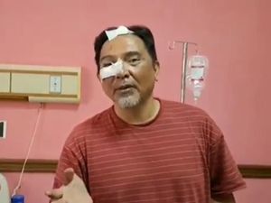 Beda Versi Pilot John dan yang Dilaporkan Turkish Airlines ke Polisi