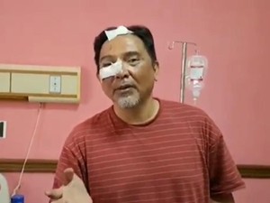 Beda Versi Pilot John dan yang Dilaporkan Turkish Airlines ke Polisi