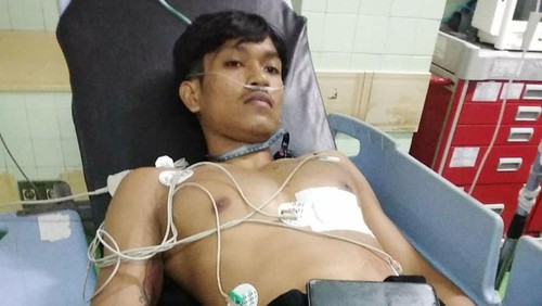 Petugas parkir RSUP Prof Ngoerah, Kadek Yudiani (21), yang menjadi korban penusukan sopir ambulans.