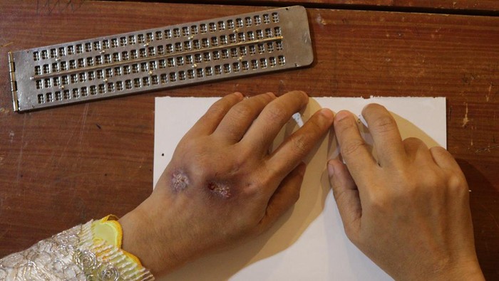 Sejumlah penyandang tunanetra mengikuti lomba menulis Braille saat Festival Tunanetra Mengaji di Surabaya, Jawa Timur, Sabtu (15/10/2022). Kegiatan lomba menulis Al Quran braille dan pentas mengaji digelar Kawan Netra bersama Ikatan Tunanetra Muslim Indonesia (ITMI) yang diikuti sekitar 200 penyandang tunanetra dari berbagai daerah. ANTARA FOTO/Didik Suhartono/rwa.