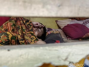 Bupati Bandung Janji Beri Bantuan Pemuda Penderita Hidrosefalus