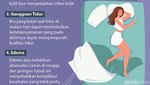 Tidur Malam Tanpa Bra, Payudara Lebih Sehat? Ini Faktanya