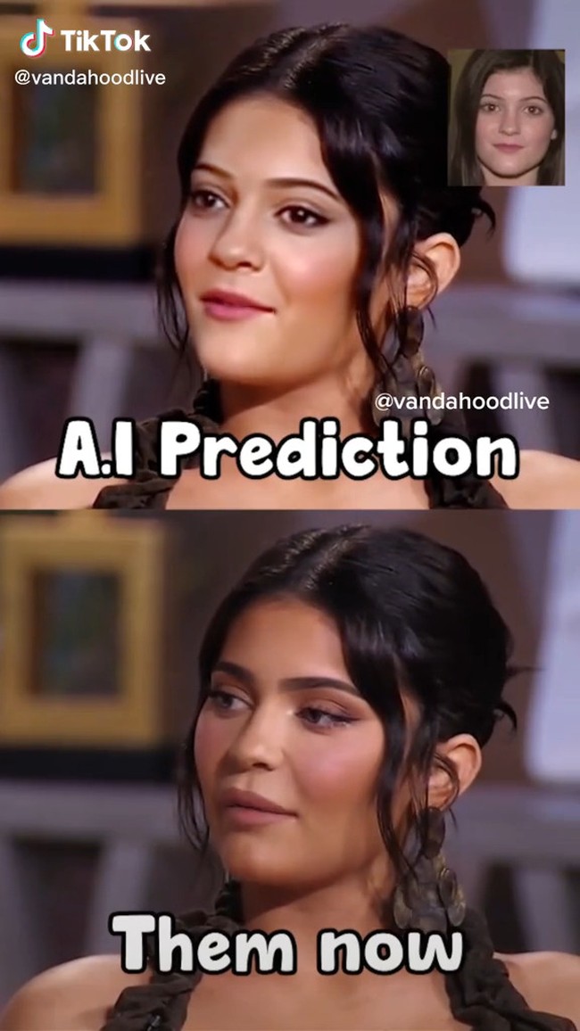 Dalam video, Kylie Jenner mengaku sejak dulu insecure dengan bibir tipisnya. Postingan itu pun menunjukkan bagaimana prediksi wajahnya jika tidak melakukan operasi plastik dan filler. Foto: TikTok @vandahoodlive