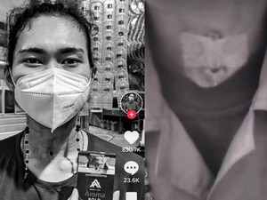Wanita Jateng Kehilangan Suara gegara Pernah Jadi Social Smoker, Begini Kisahnya