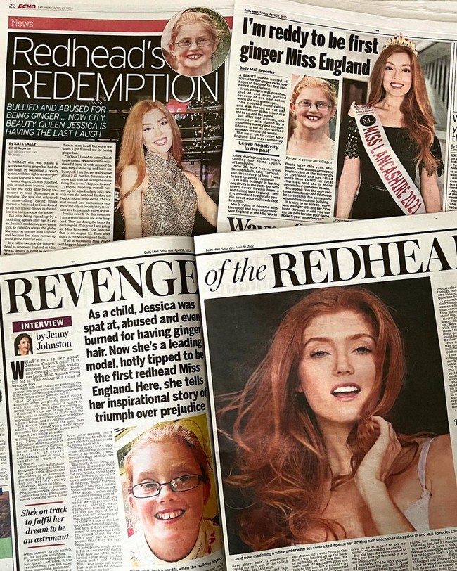 Jessica Gagen punya banyak pengalaman tidak menyenangkannya selama SMP hanya karena warna rambutnya. Jessica mengaku dulu sering dipanggil dengan berbagai sebutan, diludahi, bahkan dibakar oleh sesama murid. Ketika mulai SMP aku dijaili karena warna rambutku dan aku dulu merasa tidak percaya diri, ujarnya.Foto: Instagram Jessica Gagen