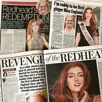 Jessica Gagen punya banyak pengalaman tidak menyenangkannya selama SMP hanya karena warna rambutnya. Jessica mengaku dulu sering dipanggil dengan berbagai sebutan, diludahi, bahkan dibakar oleh sesama murid. Ketika mulai SMP aku dijaili karena warna rambutku dan aku dulu merasa tidak percaya diri, ujarnya.Foto: Instagram Jessica Gagen