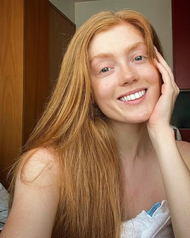 Aku pernah dipanggil Carrot Top. Caraku menanganinya adalah dengan menyimpannya sendiri. Aku mencoba untuk tidak bereaksi karena aku sudah cukup dewasa untuk tahu bahwa ada banyak anak yang tidak bermaksud jahat,Foto: Instagram Jessica Gagen