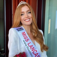 Selain cantik dan berprestasi, salah satu misi Jessica adalah mengedukasi publik agar tidak bersikap buruk terhadap orang-orang berambut merah seperti dia.Foto: Instagram Jessica Gagen