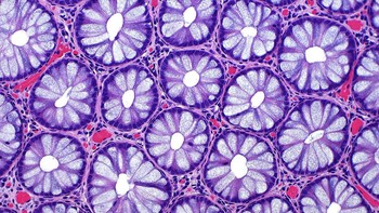 Posisi 15 karya Dr. Ziad El-Zaatari. Menampilkan Potongan melintang kripta epitel usus manusia normal Foto: Nikon Small World Photomicrography