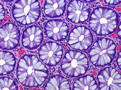 Mencengangkan! Ini Karya Jawara Kontes Foto Mikroskop