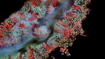 Posisi 19 karya Tagide deCarvalho. Menampilkan Biofilm bakteri pada sel lidah manusia Foto: Nikon Small World Photomicrography