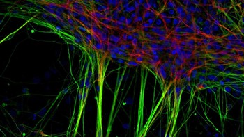 Posisi 7 karya Dr. Jianqun Gao dan Prof Glenda Halliday. Menampilkan neuron manusia yang berasal dari sel induk saraf (NSC) Foto: Nikon Small World Photomicrography