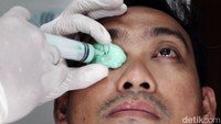 Di kediamannya itulah Rizwan pun membangun laboratorium khusus untuk membuat mata palsu lengkap dengan peralatan dan bahan yang dibutuhkan. Belajar dari internet ia pun berusaha sendiri dan berkali-kali gagal. Tapi semua itu tak menyurutkan tekad dan niat baiknya untuk buah hati dan orang lain.