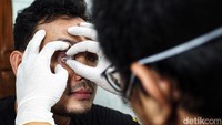 Selain karena kepercayaan diri, mata palsu juga memiliki fungsi mengisi kekosongan rongga mata sehingga mempertahankan bentuk soket mata dan wajah tidak berubah bentuk. Selain itu menghilangkan potensi terjadinya infeksi yang masuk melalui soket mata.