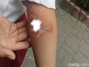 Bocah Yatim Piatu Gresik Dianiaya, Sering Kelaparan Minta Makan Tetangga