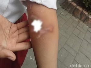 5 Fakta Pilu Bocah Yatim Gresik Dianiaya Kakak Tiri-Jadi Tukang Tambal Ban