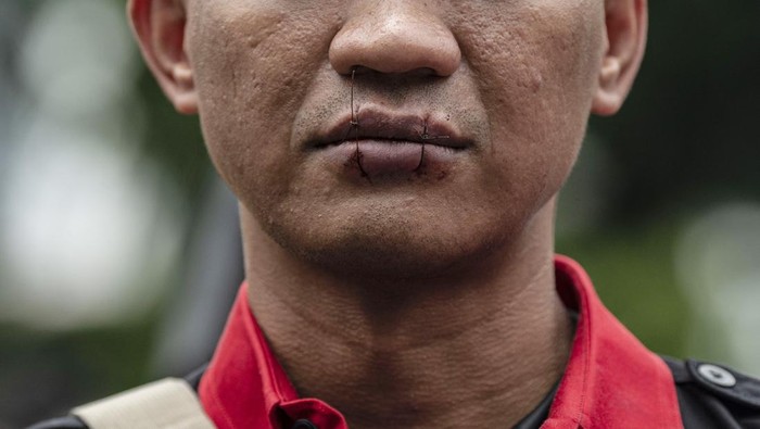 Seorang Pengunjuk rasa menjahit mulutnya saat melakukan demo.