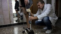 Arthur mendapatkan kaki prostetiknya dari teknisi senior Oleksandr Stetsenko di pusat Ortotech Service Prosthetic, Jumat (14/10/2022).