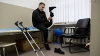 Perang di Ukraina telah menghasilkan semakin banyak orang yang diamputasi sipil dan militer, meskipun pihak berwenang belum merilis angka resmi korban.
