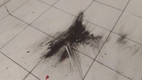 Dampak dari pencemaran tersebut, masyarakat mengeluh karena setiap saat harus membersihkan selasar rumah yang dikotori debu batu bara. Selain itu, beberapa warga juga mulai mengalami batuk karena dampak dari pencemaran tersebut. (dok Istimewa)