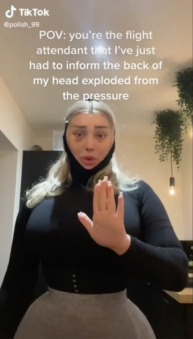 Weronika, model yang populer di TikTok dan OnlyFans menceritakan pengalaman mengerikan yang baru dialaminya. Saat naik pesawat, dia merasakan kepalanya seperti ‘meledak’. Foto: Instagram/@polish.99 dan TikTok