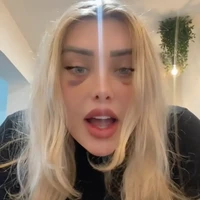 Wanita asal Inggris ini menjalani operasi plastik pada kelopak matanya untuk mendapatkan efek seperti ‘cat eye’. Operasi itu dijalani di Turki. Foto: Instagram/@polish.99 dan TikTok