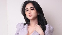 Arlida Putri mengaku pernah ditowel penonton di bagian sensitif saat hendak manggung. (Foto: dok Instagram)