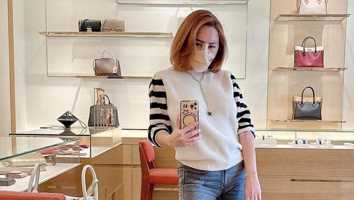 6 Foto Femmy Permatasari Jajal Oplas di Korsel, Begini Hasilnya