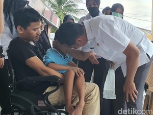 Saat Bocah yang Dilusut Api Rokok Minta Ayah Tirinya Dipenjara Seumur Hidup