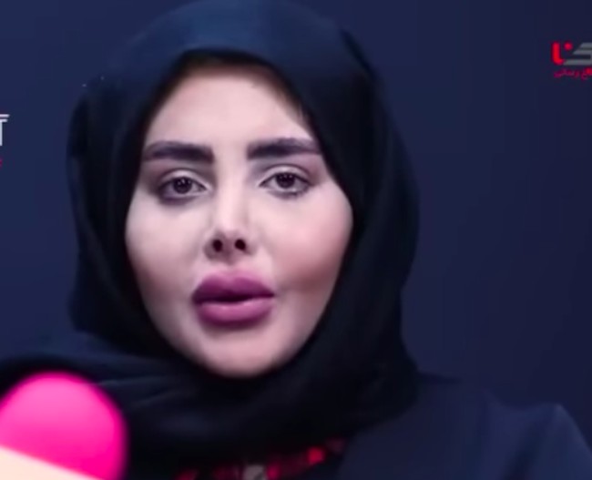 Inilah wajah asli Sahar Tabar tanpa filter. Ini menjadi penampilan perdananya dengan wajah aslinya. Foto: dok. Rokna