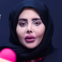 Inilah wajah asli Sahar Tabar tanpa filter. Ini menjadi penampilan perdananya dengan wajah aslinya. Foto: dok. Rokna