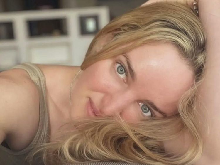 Potret Charlie Forde, Dokter Hewan Cantik yang Nyambi Jadi Bintang Porno