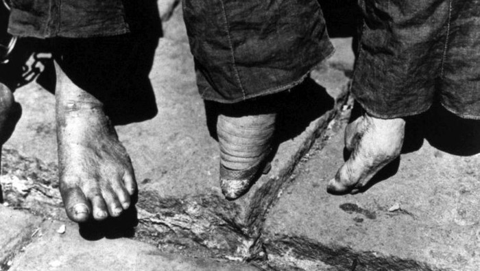 Tradisi Lotus Feet menjadi tradisi yang harus dilakukan oleh para wanita di Tiongkok Zaman dulu. Tradisi ini dikenal dengan meremukkan jari kaki sehingga terlihat mungil.