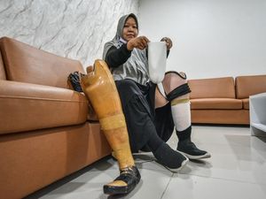 Kanker Tulang: Pengertian, Gejala, Faktor Risiko, dan Cara Mengobati