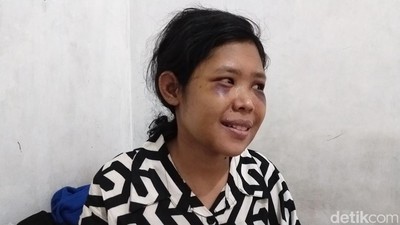 Senyum ART Rohimah yang Kembali Usai Disiksa Pasutri Sadis KBB