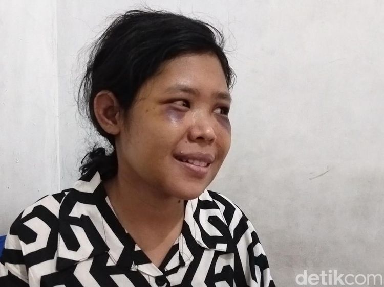 Senyum ART Rohimah yang Kembali Usai Disiksa Pasutri Sadis KBB