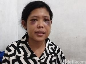 Keluarga Pasutri Penyiksa ART Rohimah Sempat Sodorkan Uang Damai