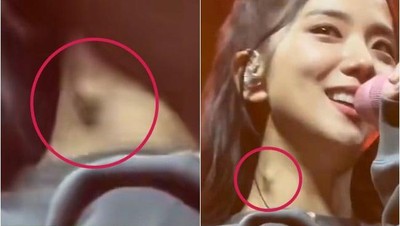 Viral Foto Jisoo BLACKPINK Ada Benjolan di Leher, Fans Khawatir Tumor Ganas