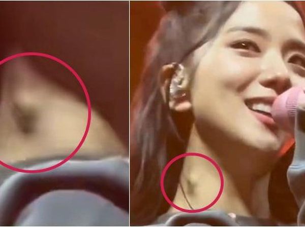 Viral Foto Jisoo BLACKPINK Ada Benjolan di Leher, Fans Khawatir Tumor Ganas