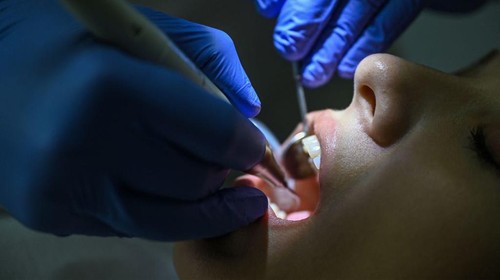 A dentist and his assistant work on a patient at a dental clinic in Istanbul on September 16, 2022. - Attracted by unbeatable prices, fast turnaround times and the promise of a bright smile, 150,000 to 250,000 foreign patients will travel to Turkey for treatment this year, according to the Turkish Dental Association (TDB), making the country one of the main destinations of world dental tourism. (Photo by Ozan KOSE / AFP) (Photo by OZAN KOSE/AFP via Getty Images)