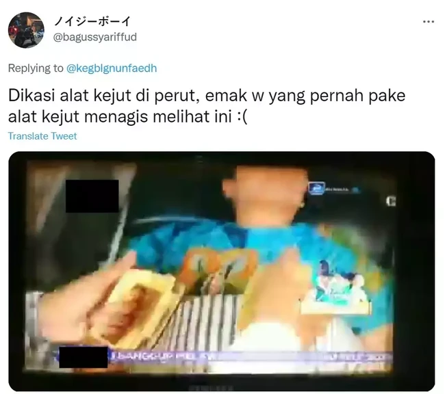 Apakah jantung pasien yang satu ini letaknya berada di perut? Jadi miris dan ikutan makin sedih deh lihatnya. Foto: Twitter/@bagussyariffud